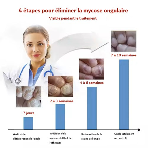 Sérum réparateur concentré pour ongles abimés Lepi Nohti Nails™