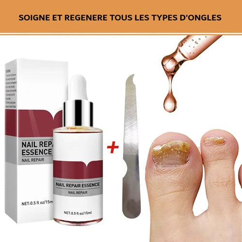 Sérum réparateur concentré pour ongles abimés Lepi Nohti Nails™