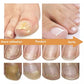 Sérum réparateur concentré pour ongles abimés Lepi Nohti Nails™